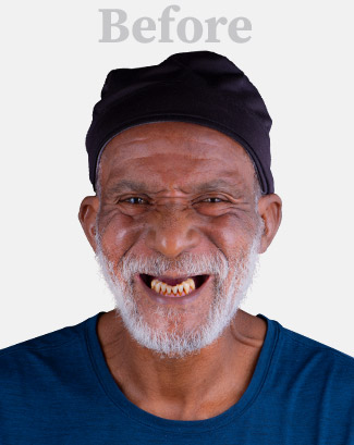 man after his dental treatment in Los Algodones, Mexico