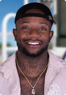 young black male smiling after getting dental veneers in los Algodones at Dental Clinic Mexico