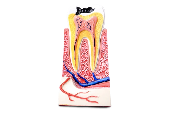 dental bridges in los algodones, mexico