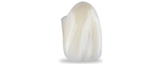 porcelain crowns cost in Los Algodones