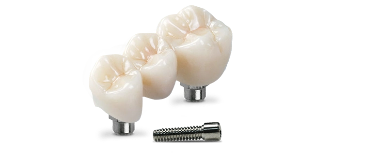 3-unit-dental bridge cost in Los Algodones, Mexico