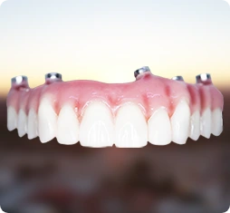 upper all on 4 hybrid denture