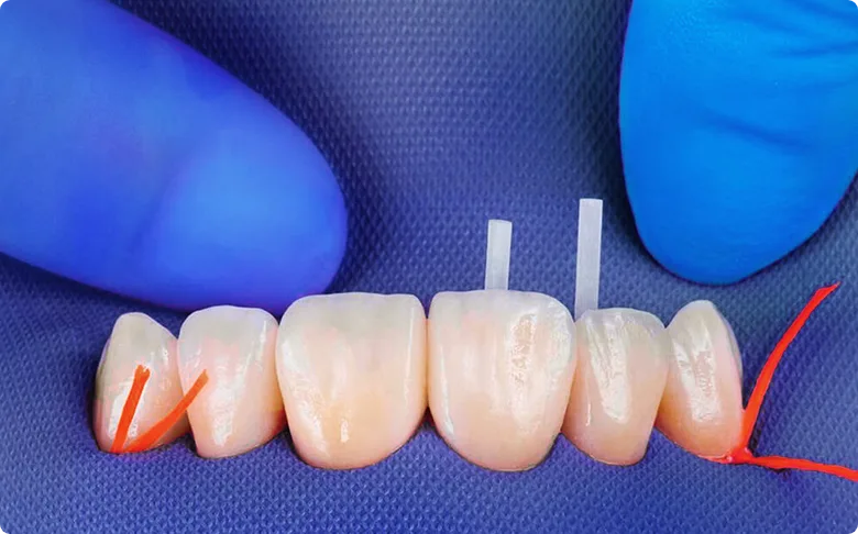 root canal procedure for a crown