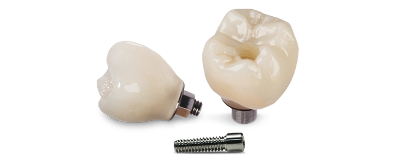 Single tooth implant crown cost in los Algodones, Mexico