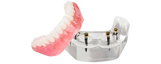 titamium dental implant in Los Algodones