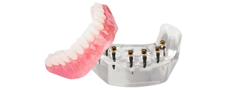 titamium dental implant in Los Algodones