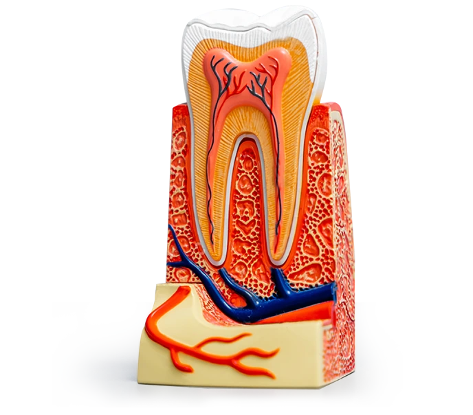 root canal treatment ilustration