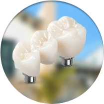 Dental implant bridges cost in Los Alogodones, Mexico