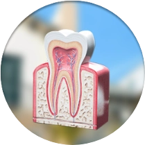 root canal prices in Los Alogodones, Mexico