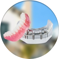 Snap-on-dentures cost in Los Alogodones, Mexico