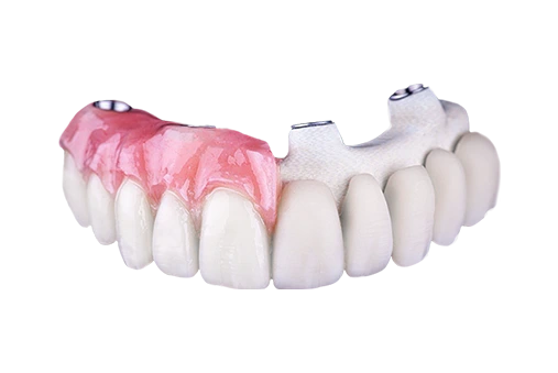 upper crystal ultra ceramic all on 4 prosthesis