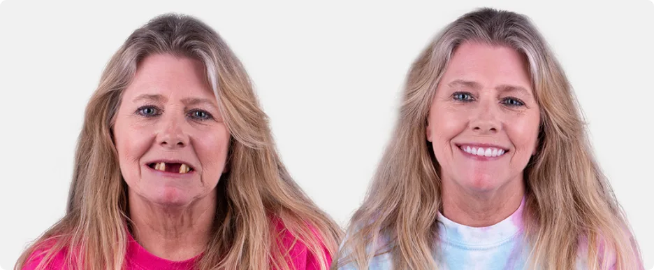 before and after photos of your dental treatment lady