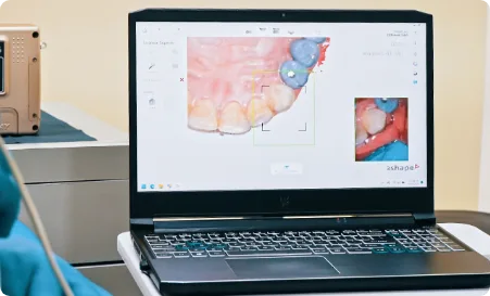 Dental clinic in Los Algodones equipped with state-of-the-art technology, including advanced imaging and diagnostic tool.