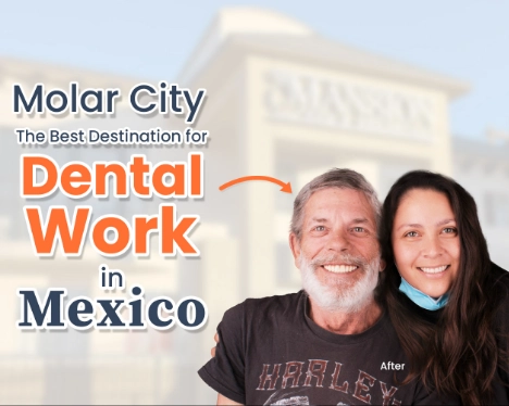 Molar City: The Best Destination for Dental Work in Mexico