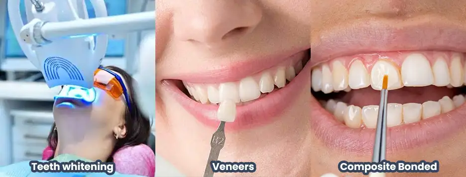 Smiling woman covering her mouth, representing the causes of yellow teeth and how to get rid of them.