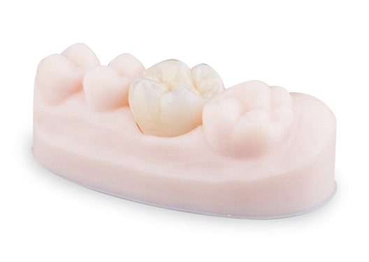 dental crowns in los algodones, mexico