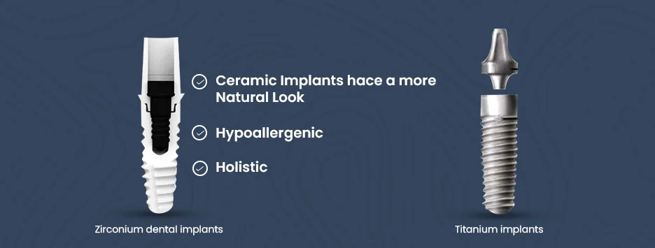 Introduction to zirconium oxide dental implants as a holistic alternative to titanium for natural-looking smiles.