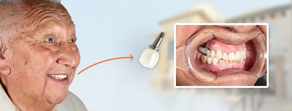 Diagram showing the resistance, aesthetic appeal, and oral health benefits of zirconium dental implants