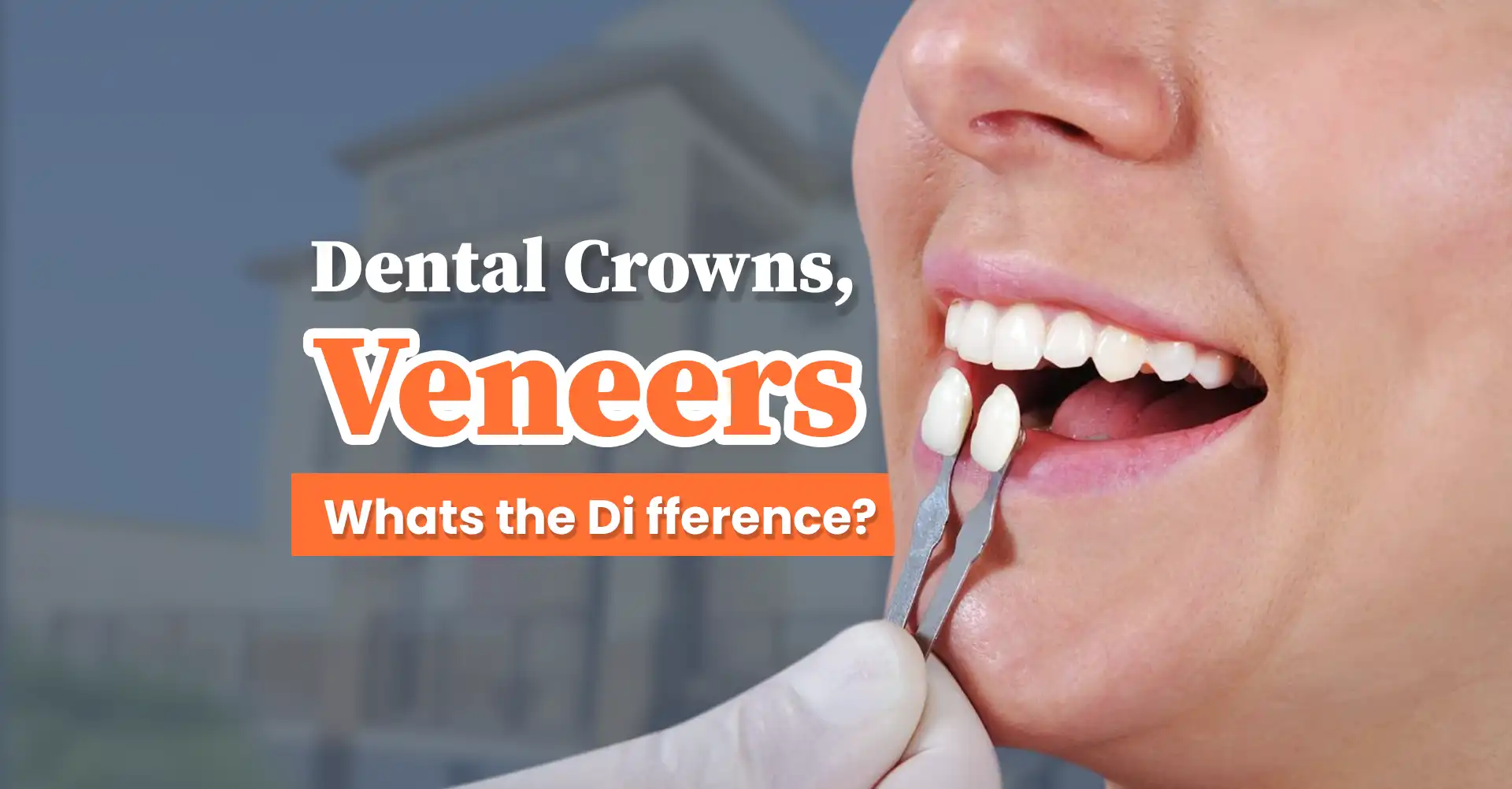Banner image highlighting aesthetic dental veneers treatment available at Smile Crafters in Molar City, Los Algodones.
